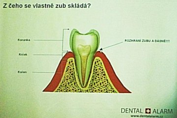 Zubní prevence